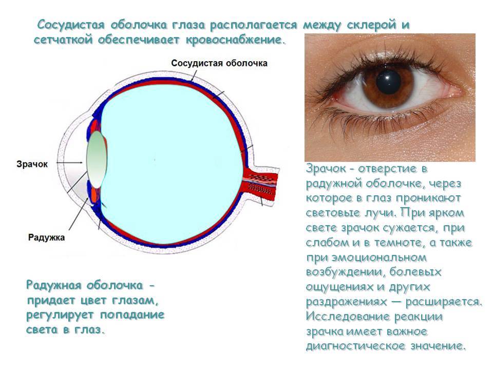 Увеиты - воспалительные заболевания сосудистого тракта глаза
