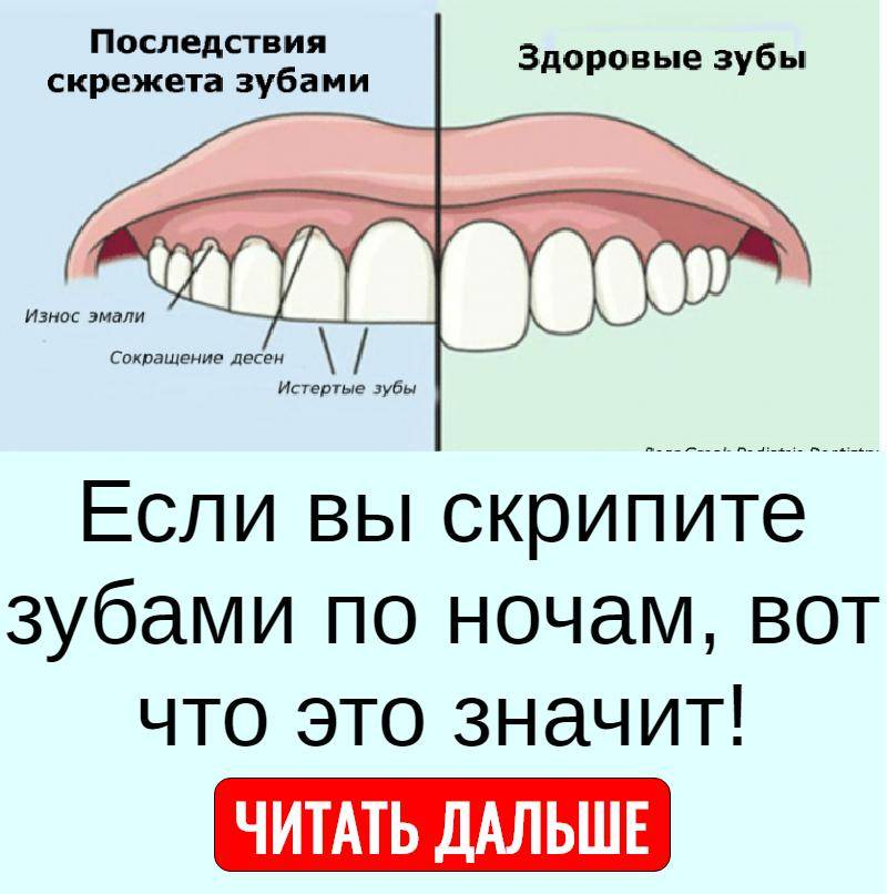 Как убрать подвижность зубов если начали шататься зубы?  | дентарт