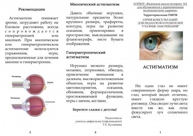 Строение и цвета козьих глаз, особенности зрачков и заболевания