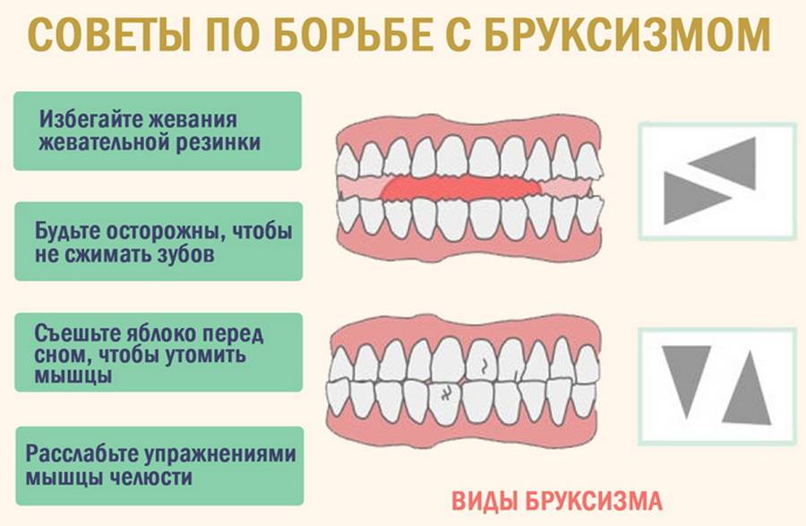 Почему могут зудеть зубы?